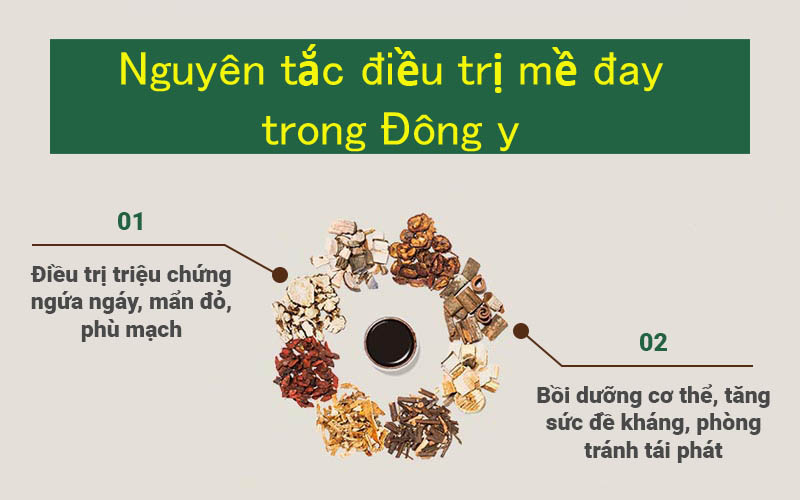 Nguyên tắc trị mề đay theo Đông y