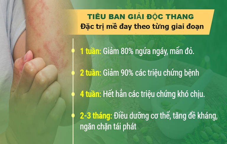 Hiệu quả điều trị mề đay của bài thuốc Tiêu ban Giải độc thang