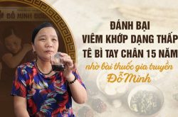 Đánh bại viêm đa khớp dạng thấp nhờ bài thuốc gia truyền Đỗ Minh Đường