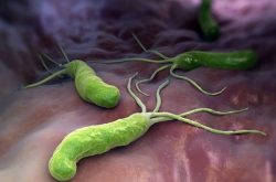 Vi khuẩn HP là gì? Vi khuẩn này có tên đầy đủ là Helicobacter Pylori
