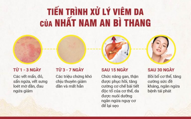 Các giai đoạn tiến triển cải thiện bệnh trong quá trình điều trị bằng Nhất Nam An Bì Thang